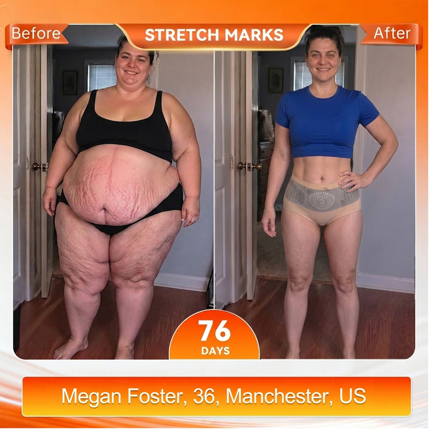 🏆Ends Today: 70% OFF! 💦🍕NESLEMY® 𝐌𝐨𝐫𝐢𝐧𝐠𝐚 & 𝐁𝐞𝐫𝐛𝐞𝐫𝐢𝐧𝐞 4‑In‑1 Micro‑Particle Sculpting & Fat‑Burn Shorts